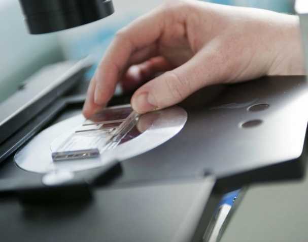 SAMe或成慢性結(jié)腸炎新希望？